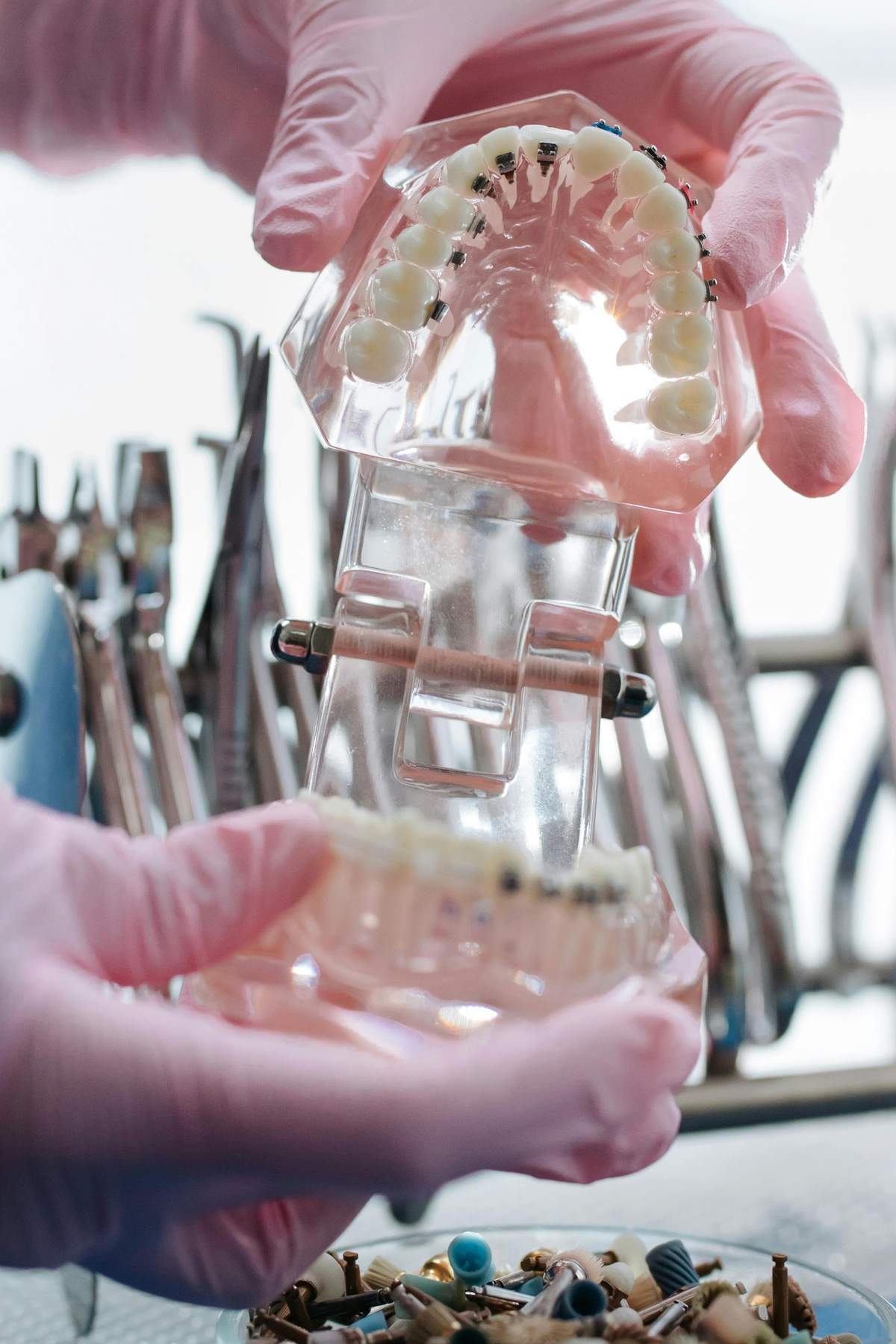 Orthodontic Biomechanics and Class III Correction using Gummetal